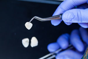 A dentist picks up dental veneers in TX with a tiny pair of tweezers