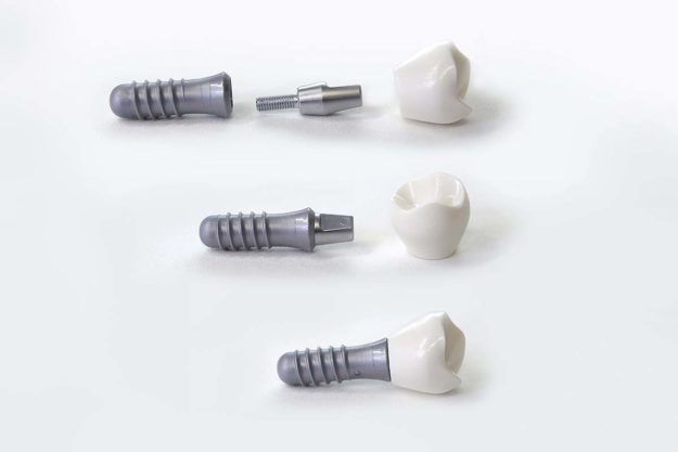 What Are Dental Implants a group of dental implants are shown