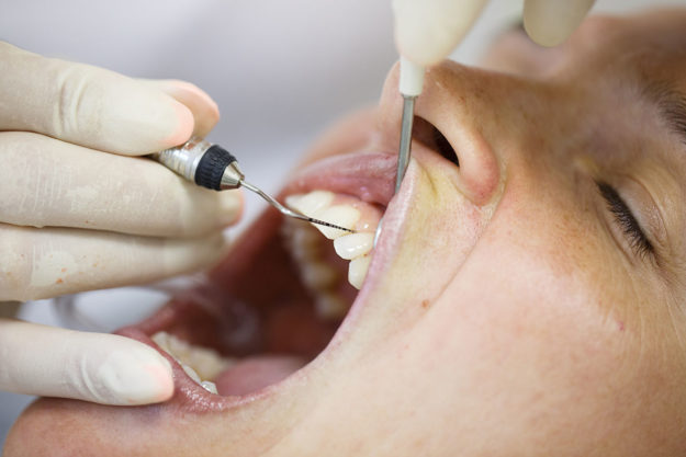 causes of receding gums (1) dentist examining gums for the causes of receding gums