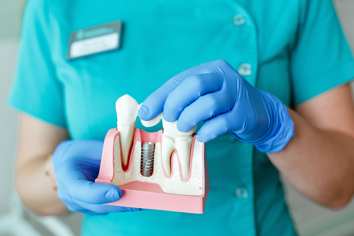 are dental implants considered oral surgery