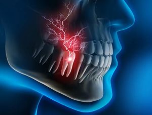 an xray shows tooth pain during a dental emergency