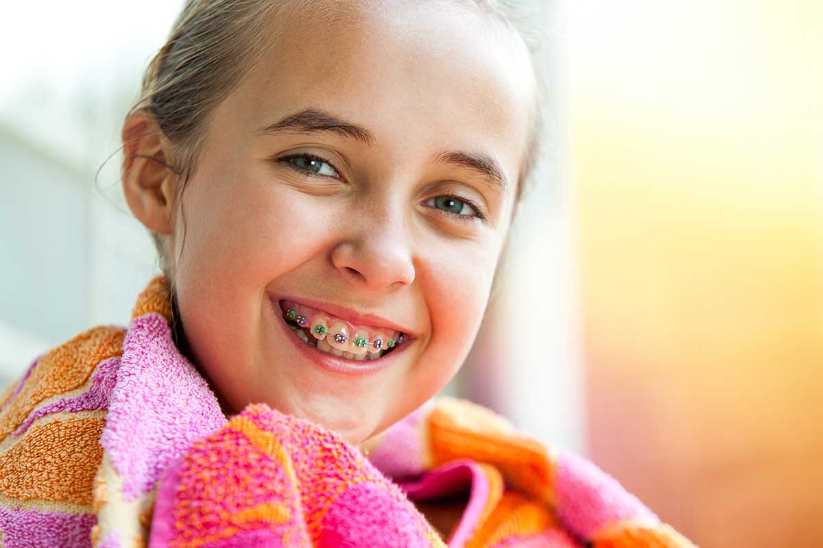 benefits of braces for kids kohrville texas