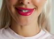 benefits of dental veneers